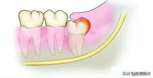 产后腹直肌分离恢复瘦肚子训练,产后腹直肌分离恢复的最佳方法