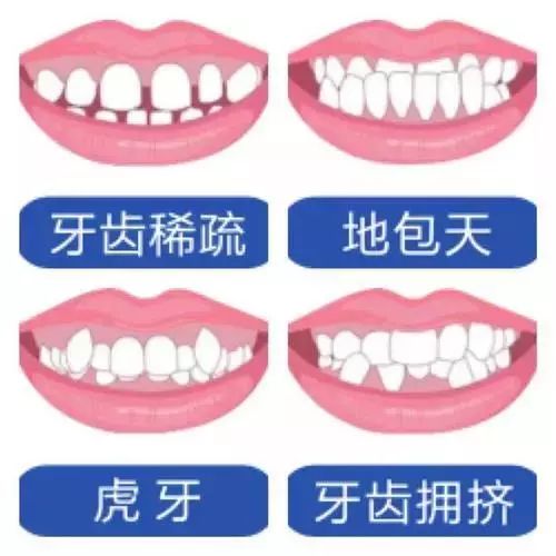 揭秘牙齿不齐的危害与矫正方式,导致牙齿有坑的原因