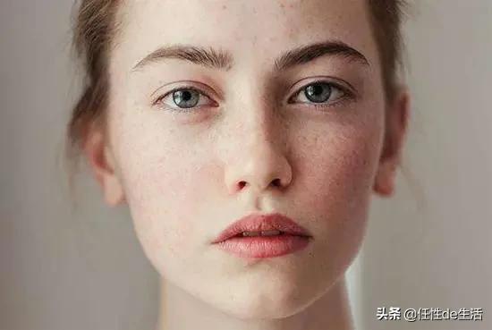 刷酸为什么避开脸颊,刷酸会垮脸吗