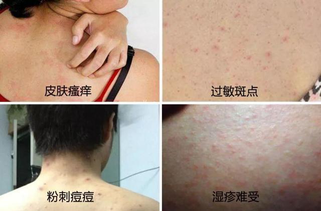 洗澡时搓出来的泥是怎么回事,为什么洗澡搓泥是白泥