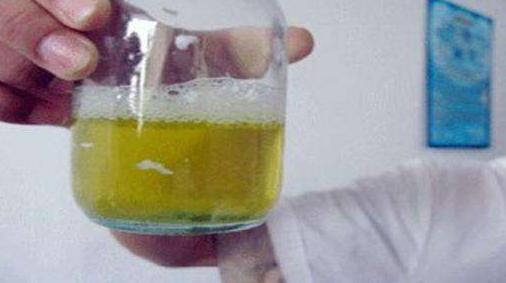 猪流尿用什么中药治,治猪尿最好的土方