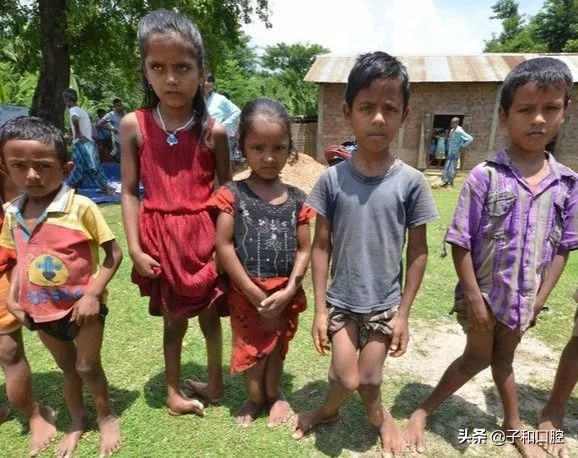 一口黄牙有多尴尬,一口烂牙怎么补救