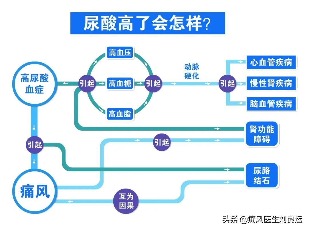 痛风医生建议不手术治疗,痛风尿酸高医生说不用吃药多喝水