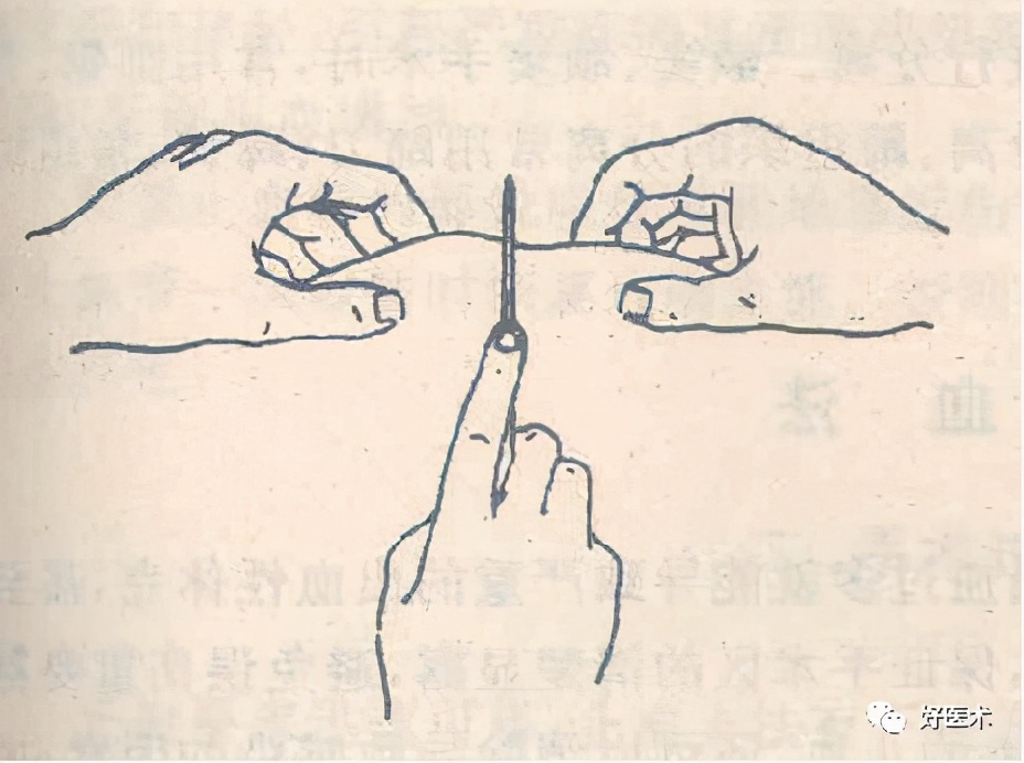 气管切开注意事项,切开引流注意事项