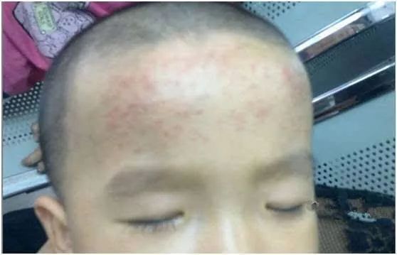 退烧贴骗父母吗,退热贴骗人案例