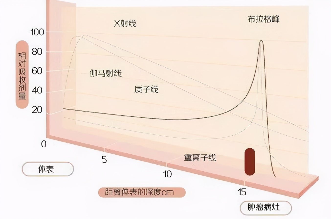 讲座+在线咨询｜肿瘤专家全面揭秘：肺癌质子治疗的优势与适应症