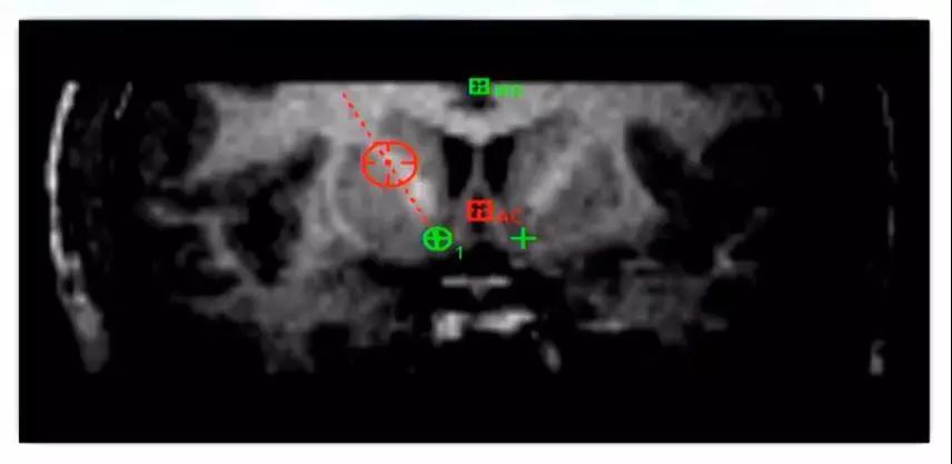 高国栋现在在哪坐诊,高国栋谈戒毒视频