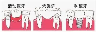 年龄增长为什么会导致牙齿缺失,长知识了真的是受益吗