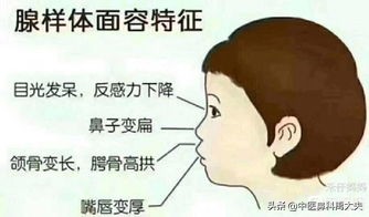 腺样体肥大是什么样子的,怎样是腺样体肥大面容