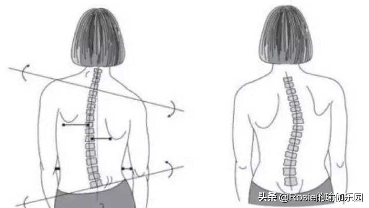 方领衣服肩带老是往下掉怎么办,穿衣服领口老是往下掉