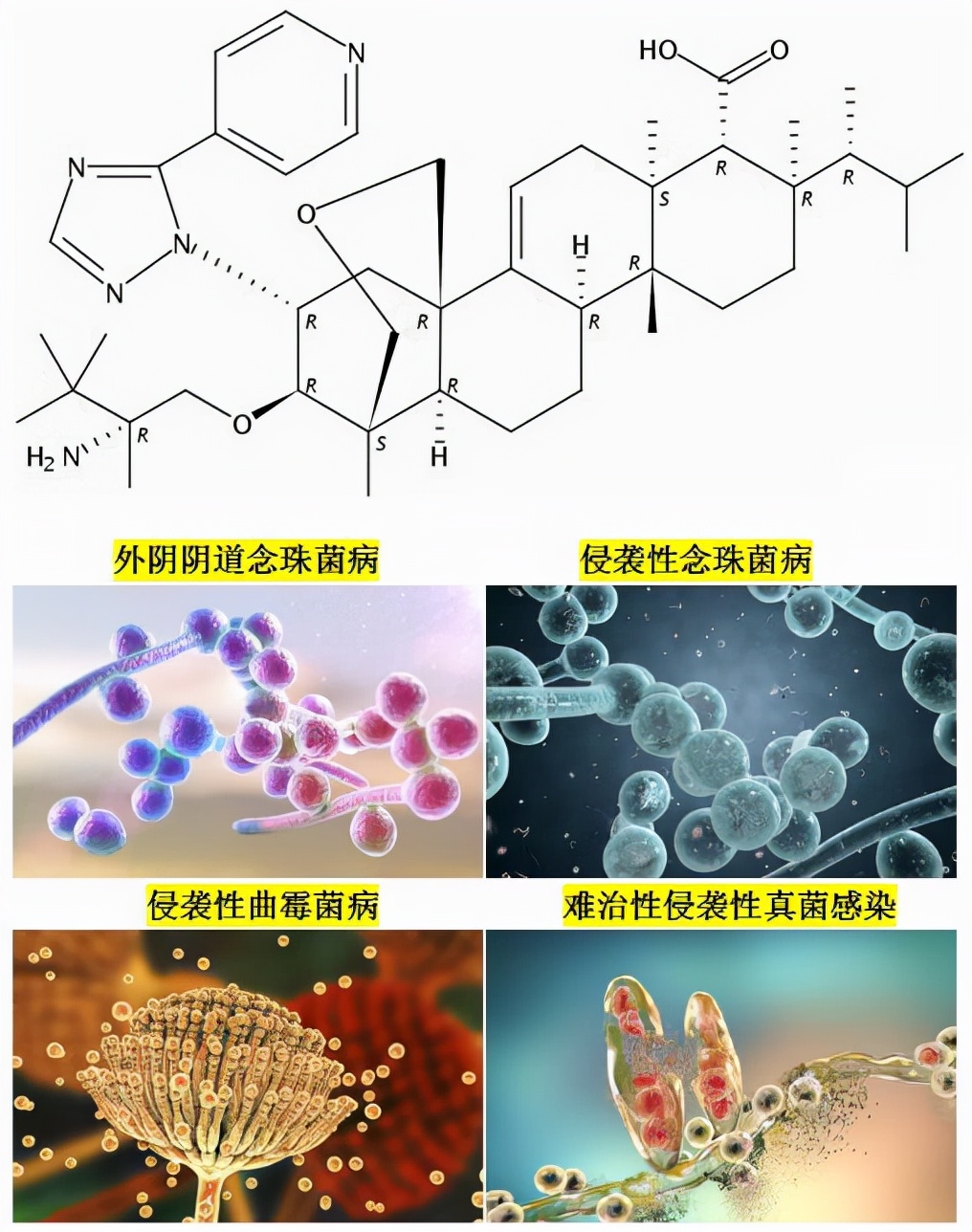 20多年来首个新一类抗真菌药:外阴阴道念珠菌病,仅需服药1天