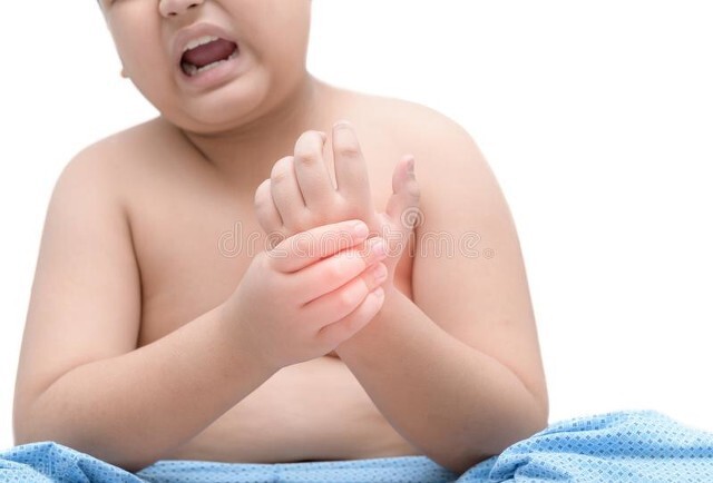 儿童风湿怎么治疗最有效,儿童风湿自愈的最简单方法