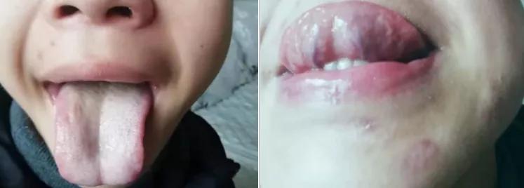 皮肤祛湿的方法,要想皮肤好排毒少不了