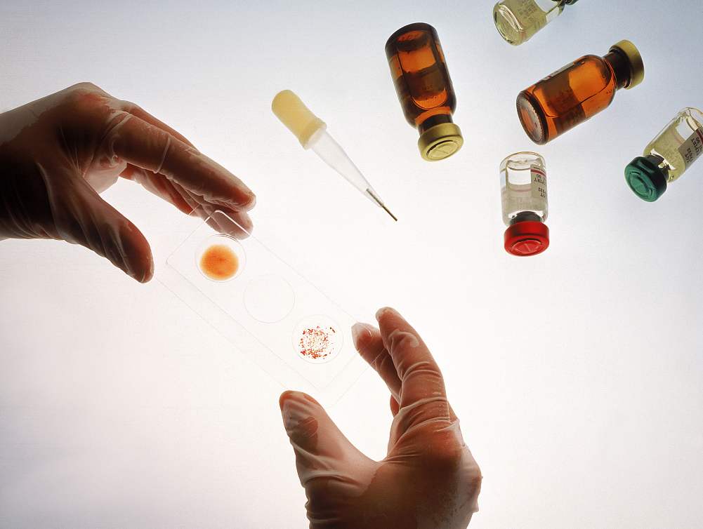 感染艾滋病毒初期有哪些征兆？可以自行检查吗？共用马桶会传染吗