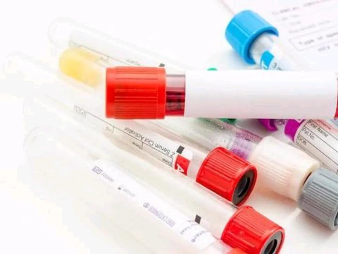 阿托伐他汀都有什么副作用视频,阿托伐他汀的副作用与禁忌