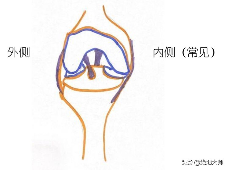 膝关节疼痛用神经阻断疗法,膝关节的疼痛与治疗综述