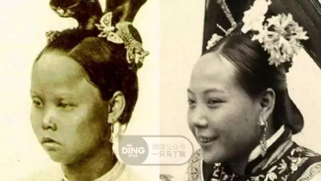 扁头有什么办法改善头型吗,扁头怎么让头变得饱满些