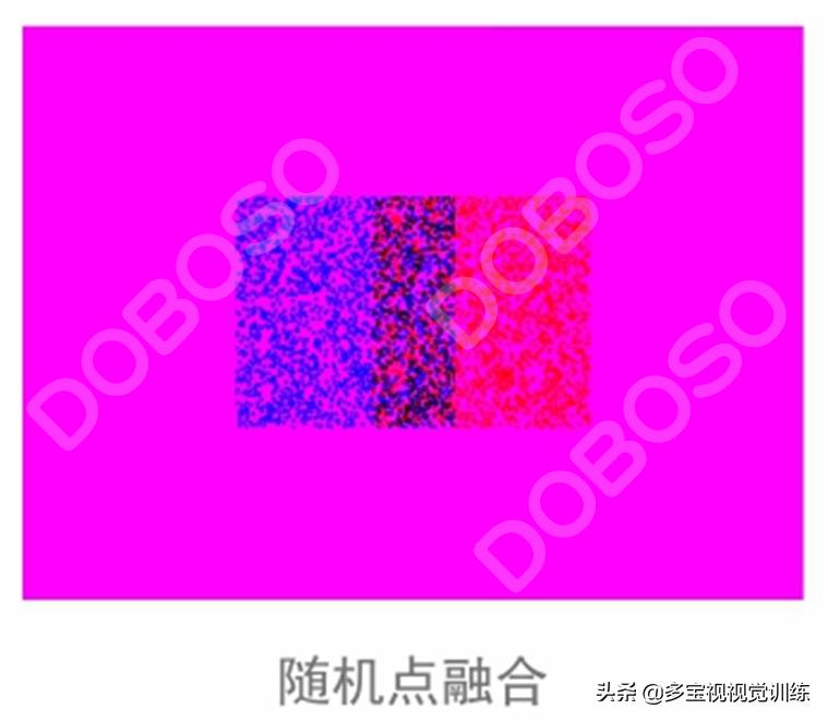 弱视单眼抑制做什么训练,弱视训练立体视是最后一步吗