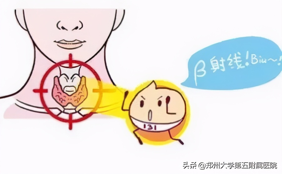 喝了131碘以后就胖了,碘131后有瘦下来的吗