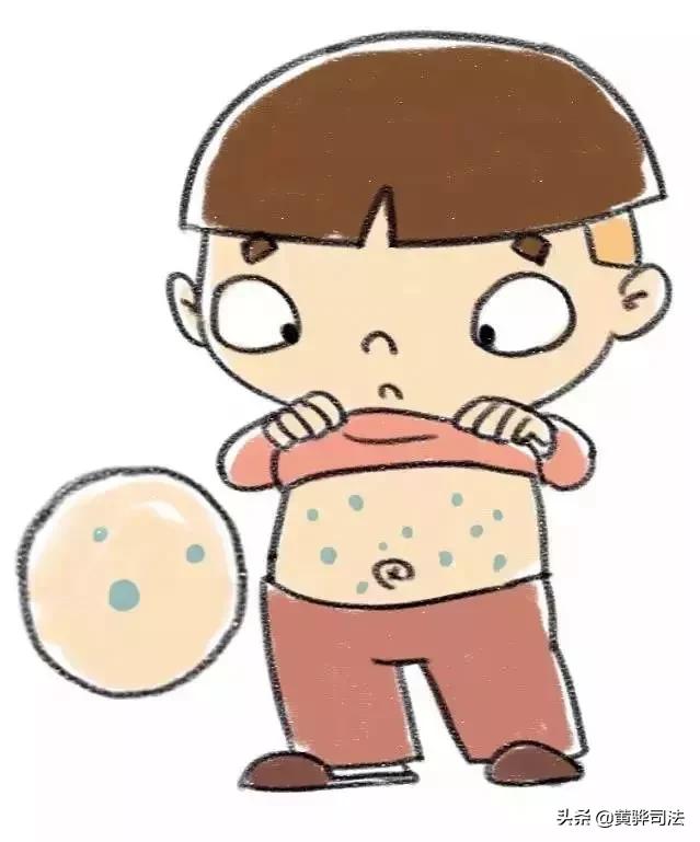 水痘高发期要注意什么,水痘进入高发期专家支招如何预防