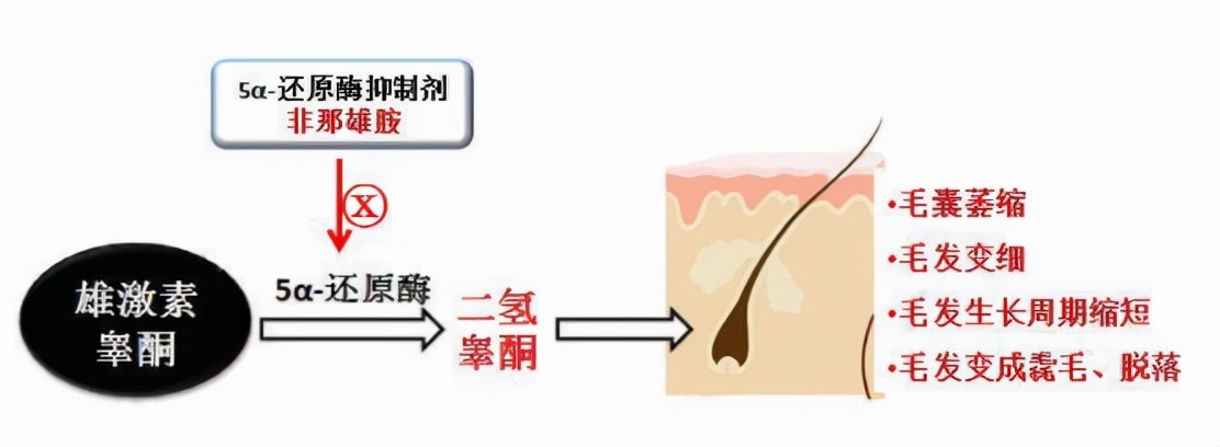 鬓角头发越来越少,头发为什么越来越少