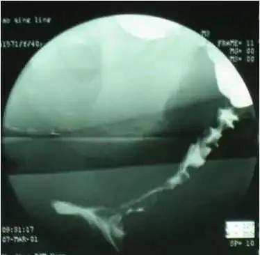 检查便秘用做肠镜吗,检查便秘的科室