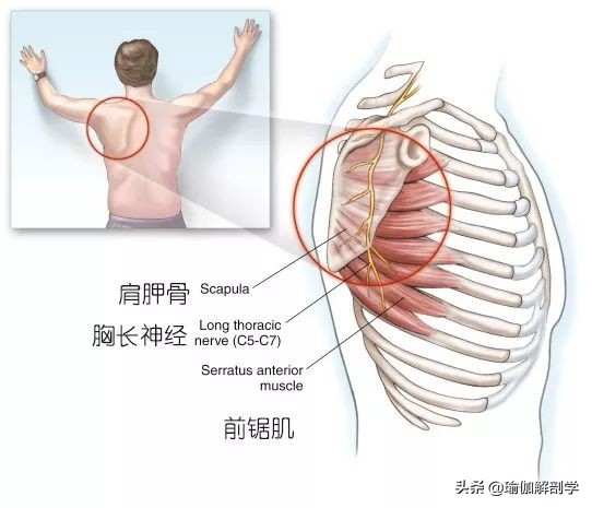 蝴蝶骨中间脊椎有凸起,翼状肩胛为何要加强菱形肌