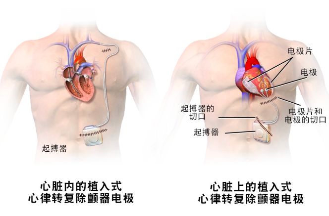 高以翔意外离世令人惋惜,高以翔不幸去世生命的警示