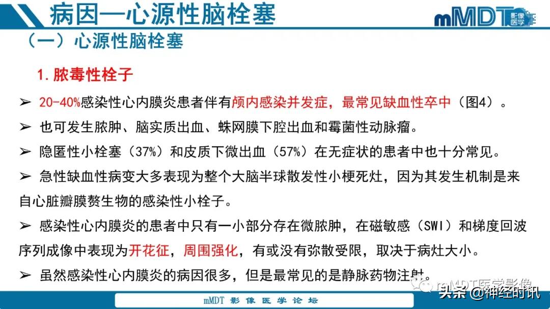 急性缺血性脑卒中ppt素材图片,青年缺血性脑卒中ppt
