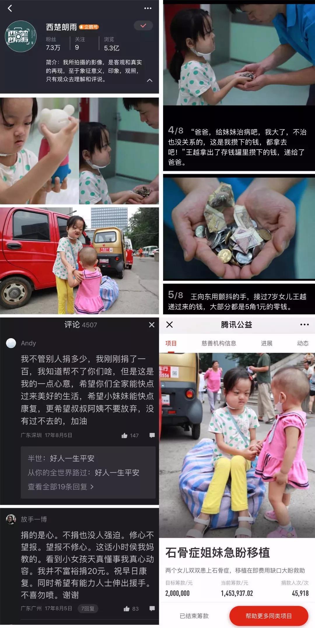 重生的喜悦|罕见病姐妹花救助近三年，冬日温暖回归探班9958