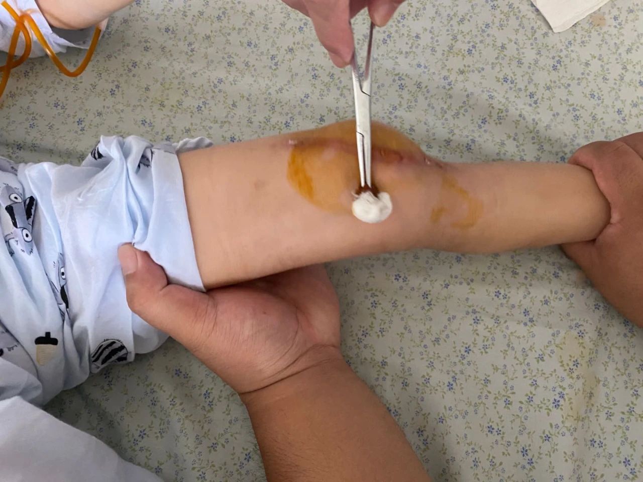 3岁小朋友说腿疼,三岁孩子老是说腿疼做什么检查呢