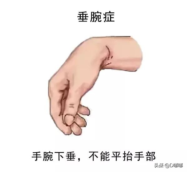 情侣间正确睡觉方法,情侣睡觉安全注意事项