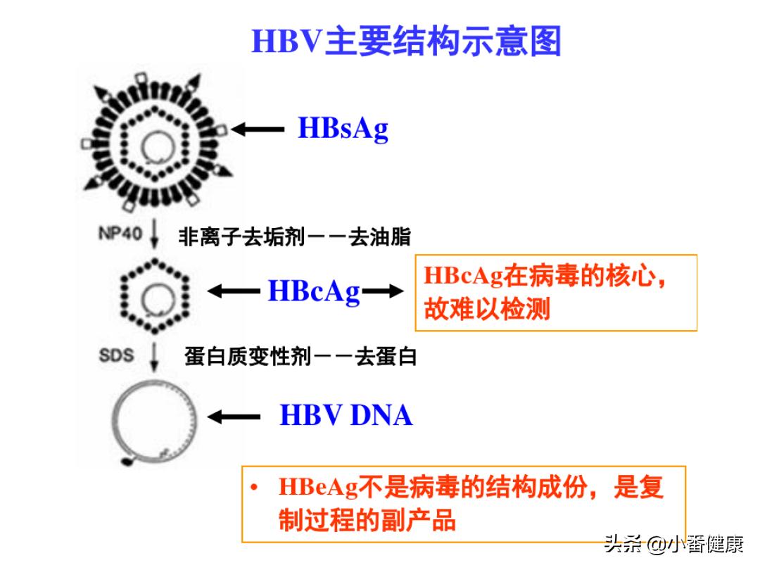 慢性乙肝出现黄疸,慢性乙肝出现黄疸升高严重吗