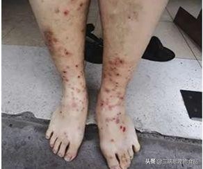 猫狗身上的跳蚤是不是除不尽,猫狗身上的跳蚤用什么能洗掉