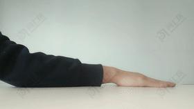 用手机大拇指腱鞘炎能自愈吗,长时间玩手机手腕腱鞘炎的案例