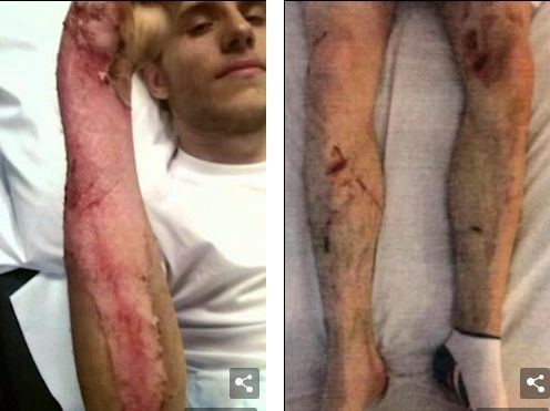 足球教练遭虐待,23岁足球教练被家暴