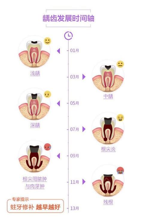 牙齿做根管治疗后补牙多少钱一颗,为什么要做根管治疗不能直接补牙