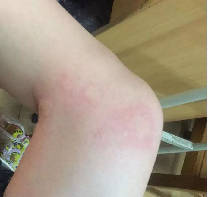 儿童春季常见疾病及治疗,当心这几类传染病近期高发