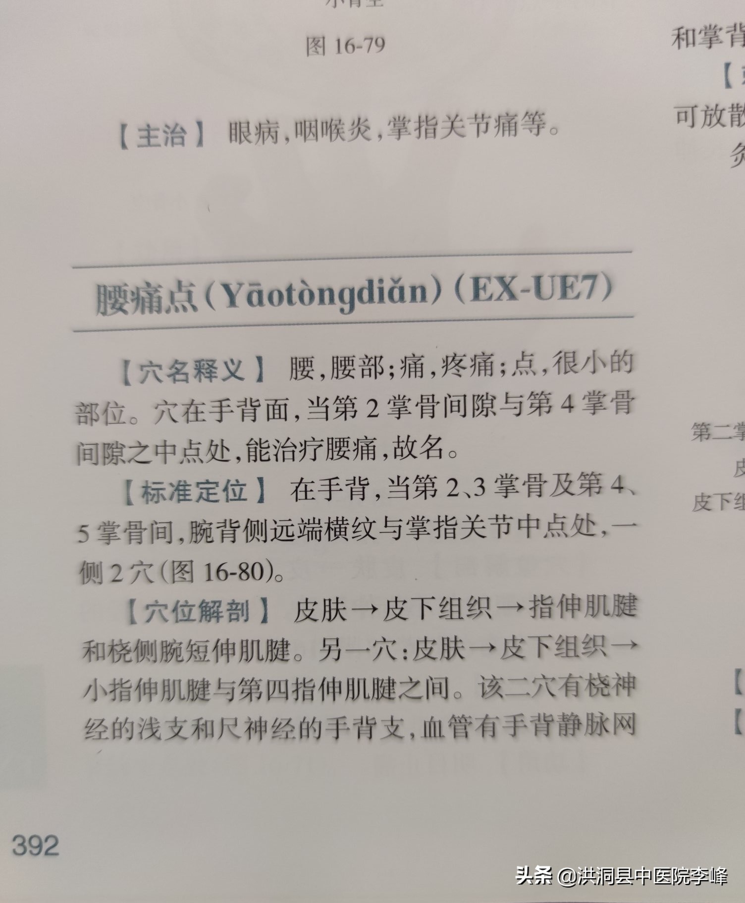 常见痛症“针刺运动疗法”特定取穴