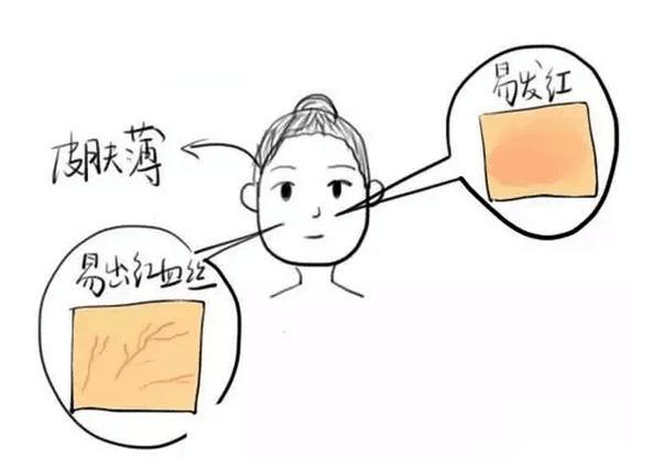 皮肤干燥急救护肤方法,皮肤干燥起皮刺痛可以用什么修护