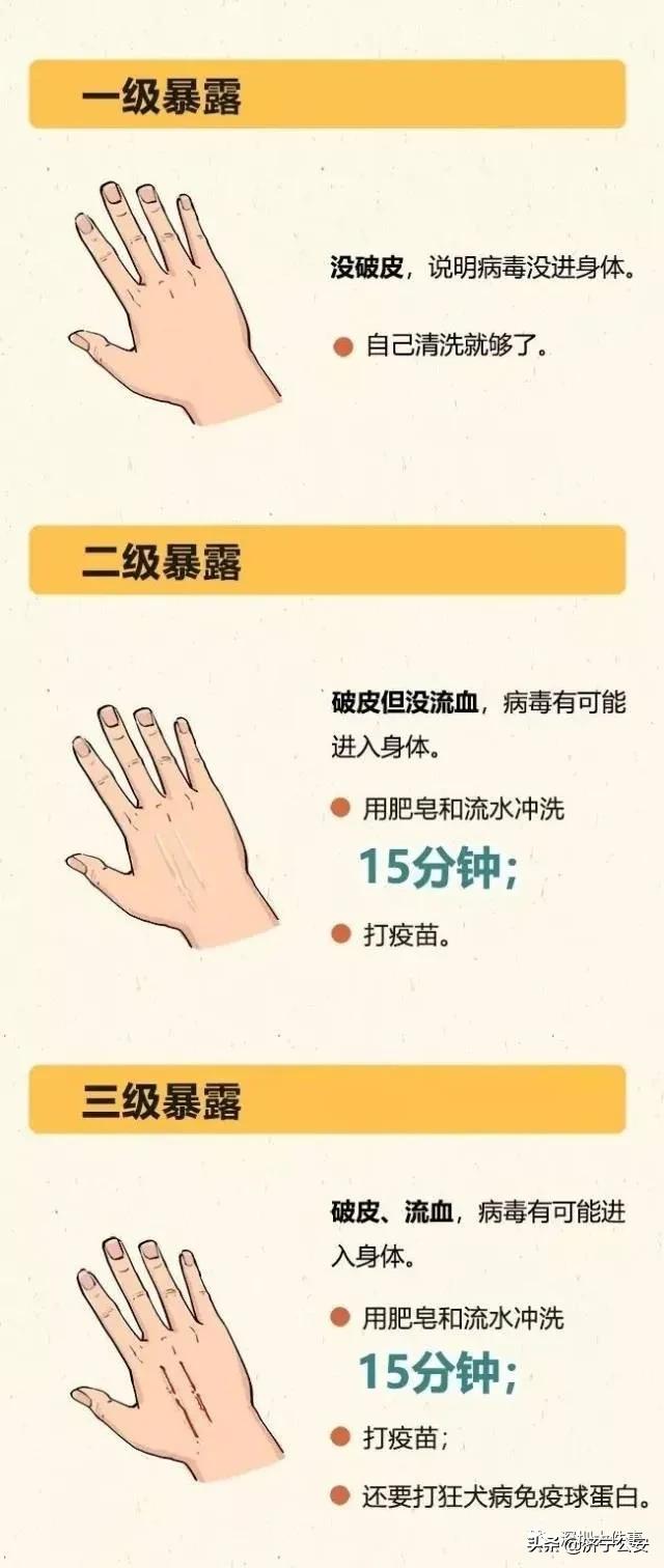 最新犬伤处置流程,关于犬伤处置