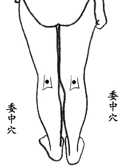 肩颈椎病手关节痛针灸哪些穴位好,颈椎病头晕呕吐针灸哪些穴位