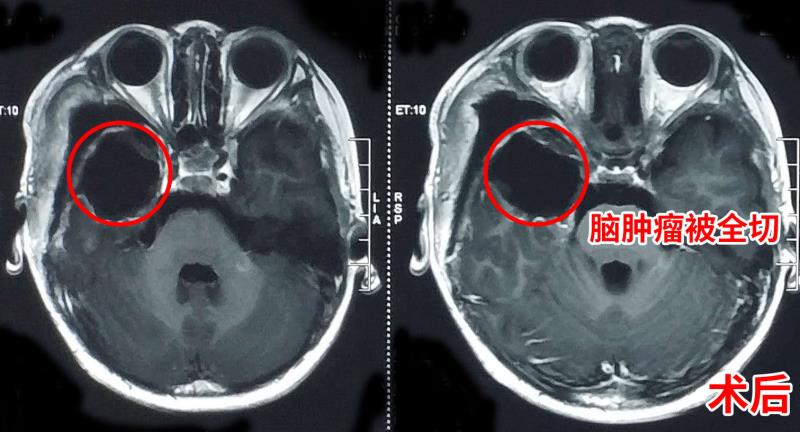 肚子里长了一群小球球,肚子里面有个圆球跑来跑去