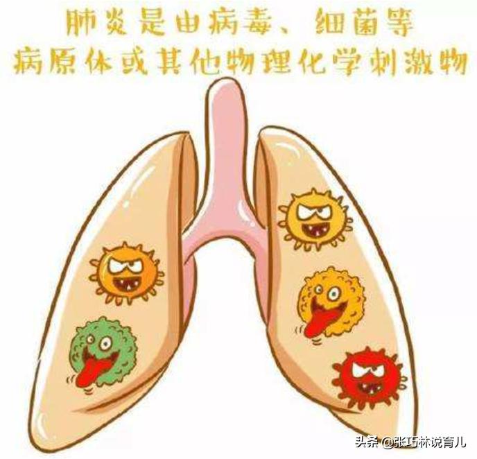 小孩得了肺炎需要打疫苗吗,小孩得了肺炎要打疫苗吗