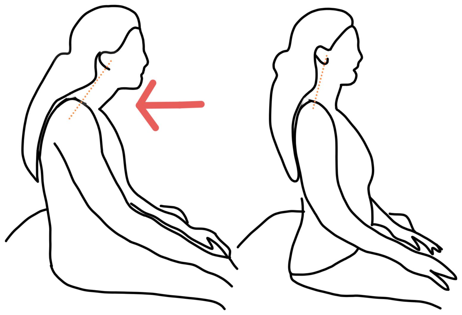 颈椎病每天睡醒脖子酸痛,睡醒脖子痛一招搞定