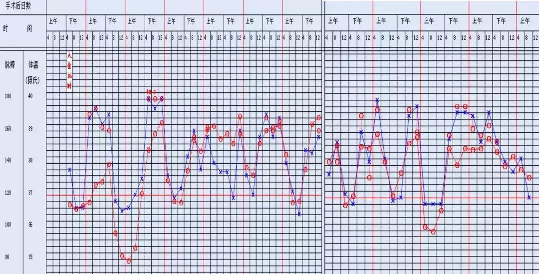 万古霉素治疗mrsa疗程,万古霉素用于mrsa的作用机制