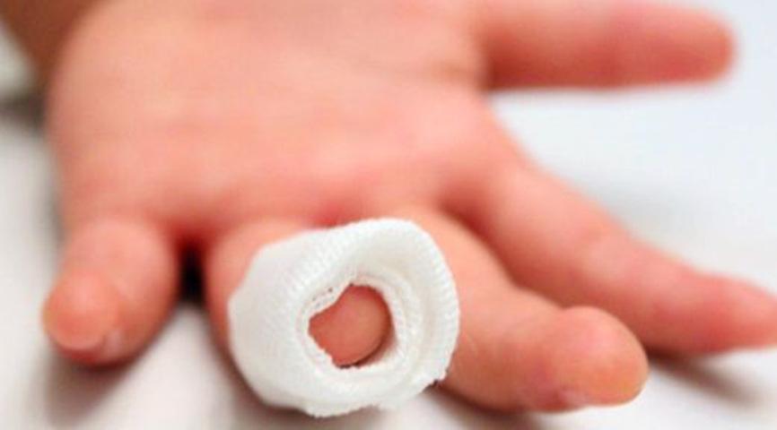 多少岁以后的疤很难愈合,为什么越长大伤口感觉愈合越慢