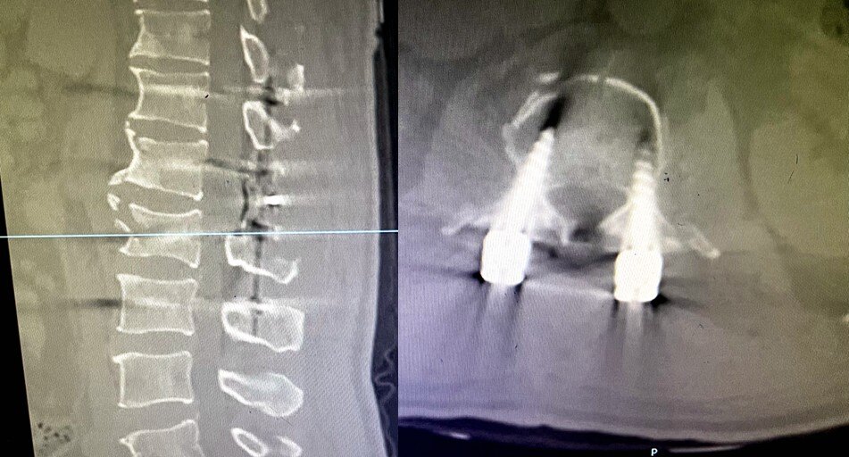 分秒必争救伤员,分秒必争的抢救