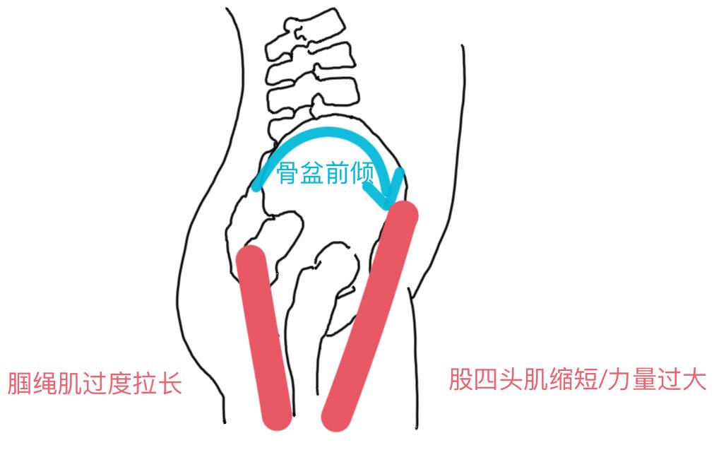跑步后6个拉伸动作教你拉伸全身,跑步后腿部肌肉紧绷不放松