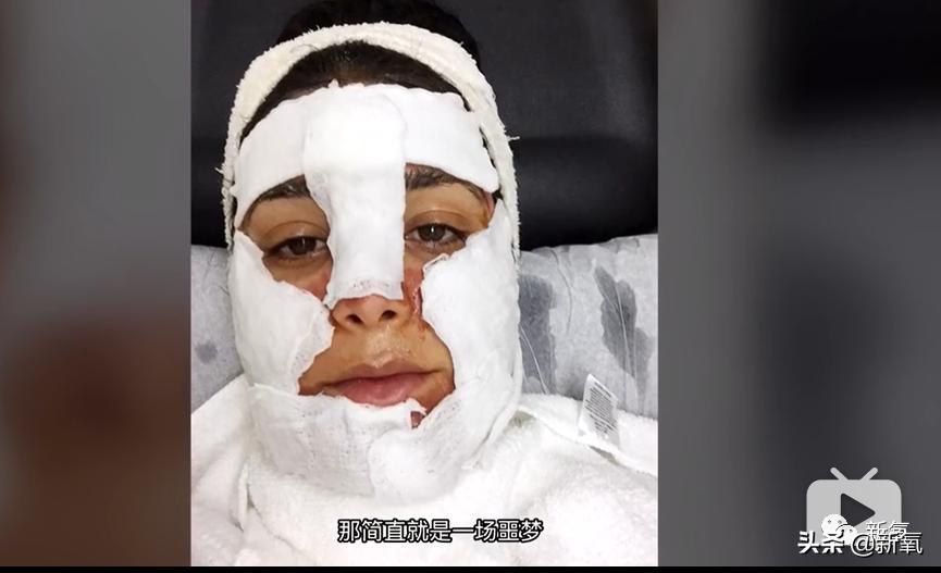 刘诗诗最近生图,刘诗诗旧照脸又胖又大